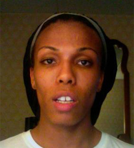 Doctor-Chettawut--facial-feminization-work-jaw-contouring-before2-surgery