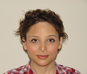 Example-of-FFS-picture-in-front-view