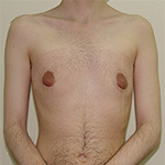 Example 3