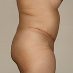 Exemple 4