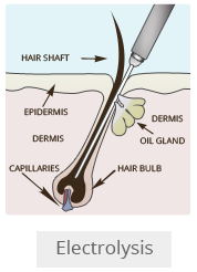 Dr. Chettawut's recommendation of genital hair removal Sex reassignment and Facial feminization surgery center Dr. Chettawut's recommendation of genital hair removal Sex reassignment and Facial feminization surgery center