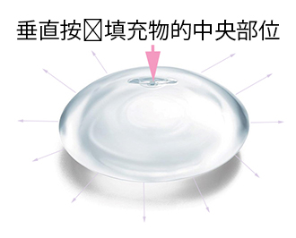 隆胸手术后如何通过正确的胸部按摩避免胸部硬化