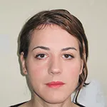 Forehead contouring + Brow lift + Trachea shave + Chin contouring surgery